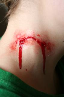 Water-Melon Bite Mark “Appliance”