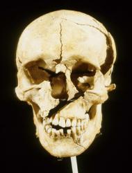 Towton_Image1-190x250